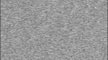 The static screen.