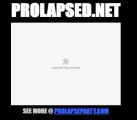 Prolapse.net